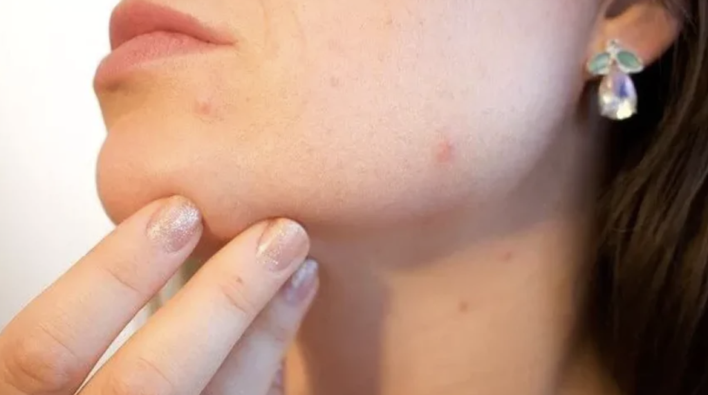 Женщина смотрит в зеркало на свою кожу с акне